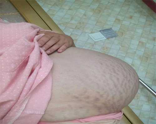 上海试管婴儿医院论坛：她曾怀孕7个月吸毒被抓