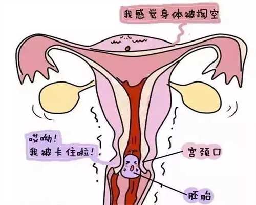 深圳最新代孕技术_带环怀孕怎么办