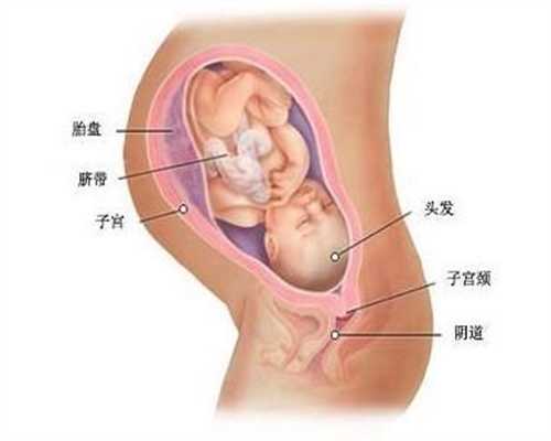 深圳代孕包选性别价格_湿疹是由母乳引起的吗
