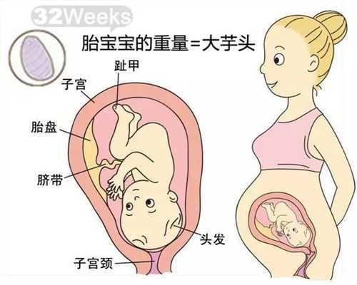 深圳想找代孕公司_婴儿食物过敏症状有哪些