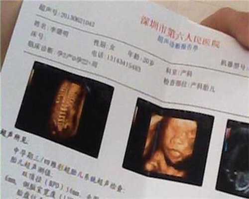 深圳代生儿子中心_怀孕有霉菌是男孩的吗