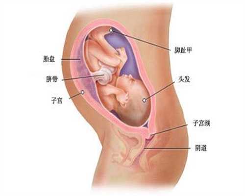 深圳代孕去哪家最好_断奶涨奶怎么办又能防止乳房变形