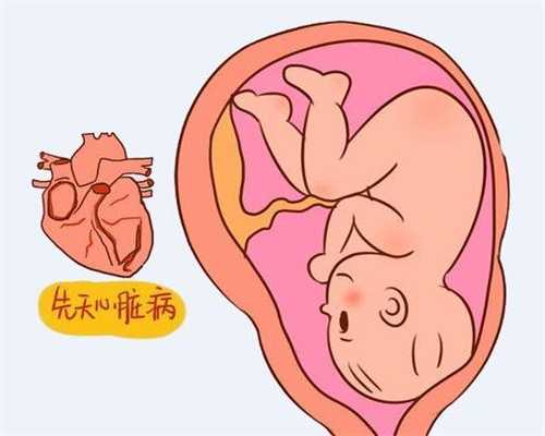 深圳代孕条件，深圳生殖医学中心，深圳代孕需要花多少钱